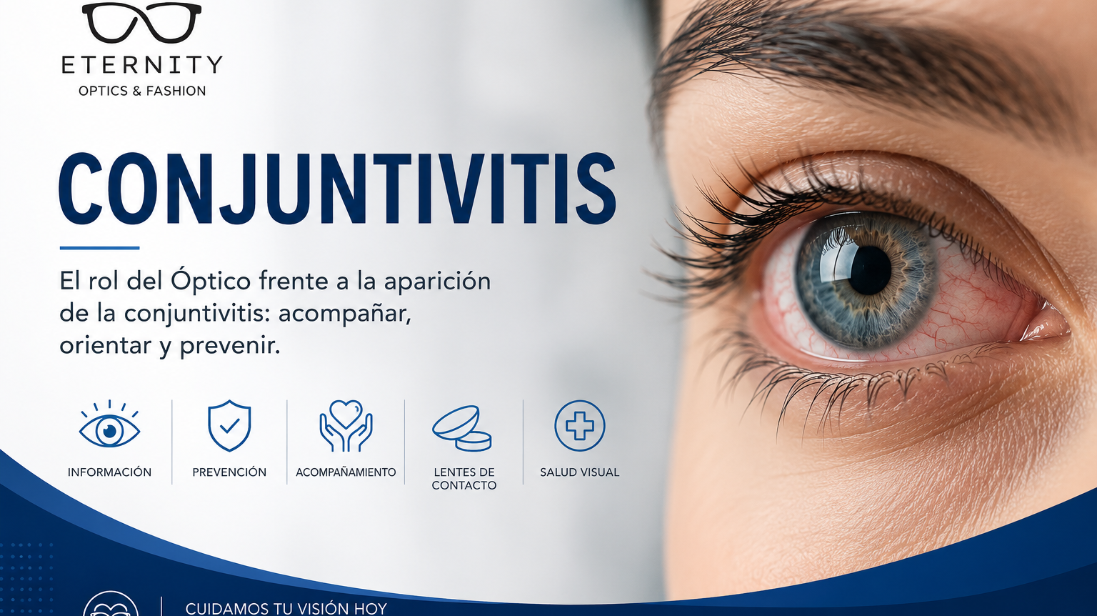 Primer plano de un ojo con enrojecimiento por conjuntivitis — Eternity Óptica